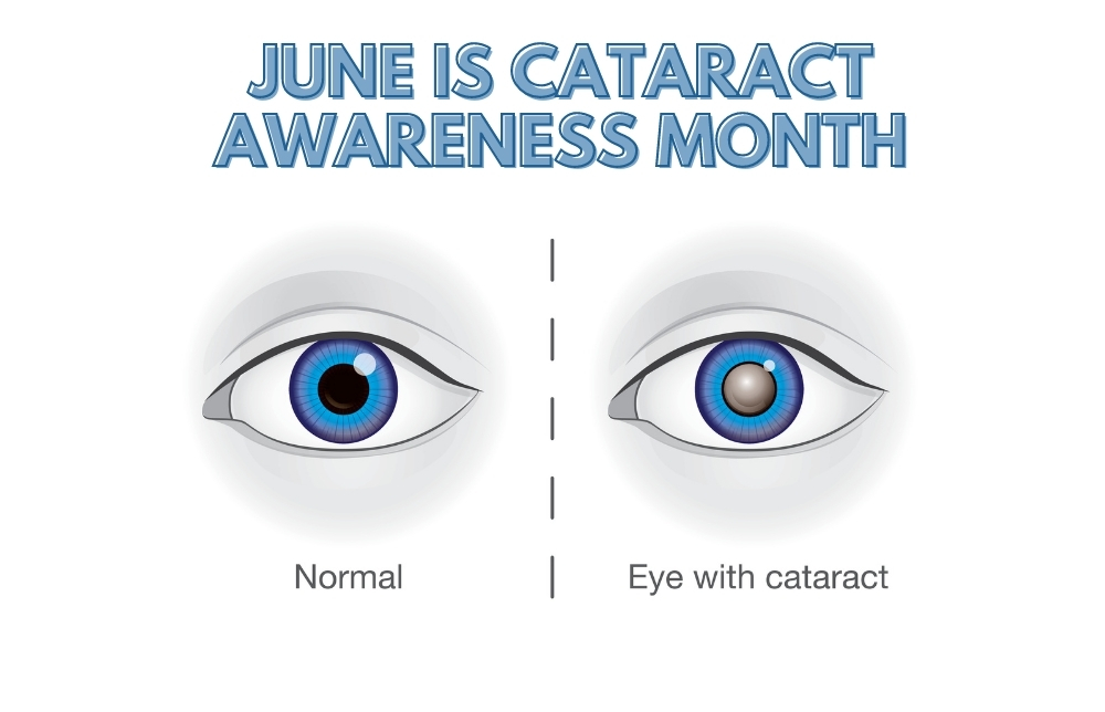 Taking A Closer Look at Cataracts Image