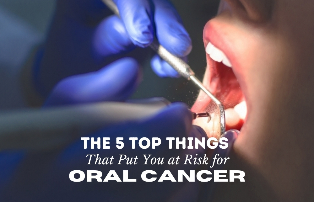 The 5 Top Things That Put You at Risk for Oral Cancer Image